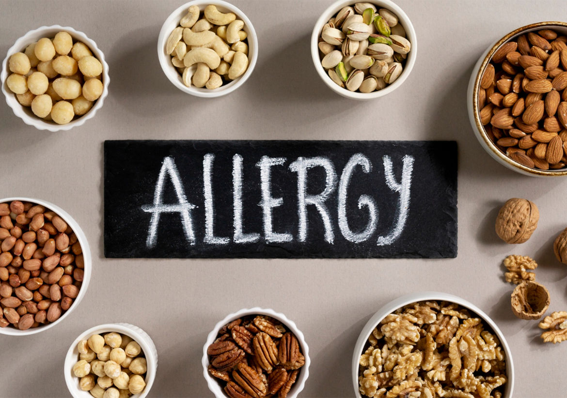 Food Allergens Awareness